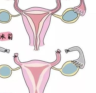 香港嘉诺撒医院的试管婴儿成功率如何？